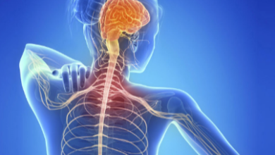 Icd 10 Multiple Sclerosis